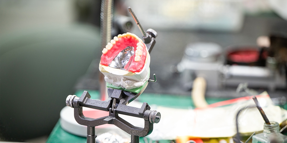 歯科技工イメージ