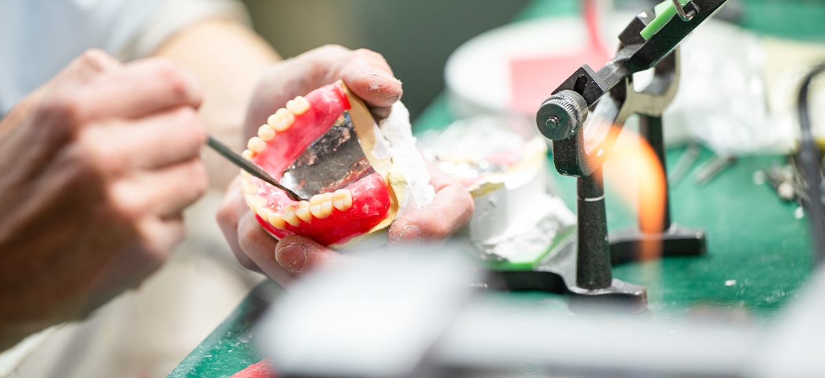 歯科技工イメージ